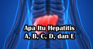 Apa Itu Hepatitis A, B, C, D, dan E