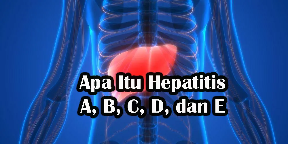 Apa Itu Hepatitis A, B, C, D, dan E